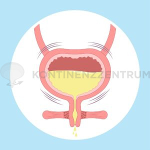 Schliessmuskel, Harninkontinenz, Inkontinenz